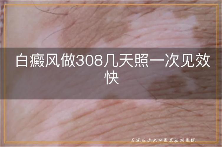 308光照一次几秒