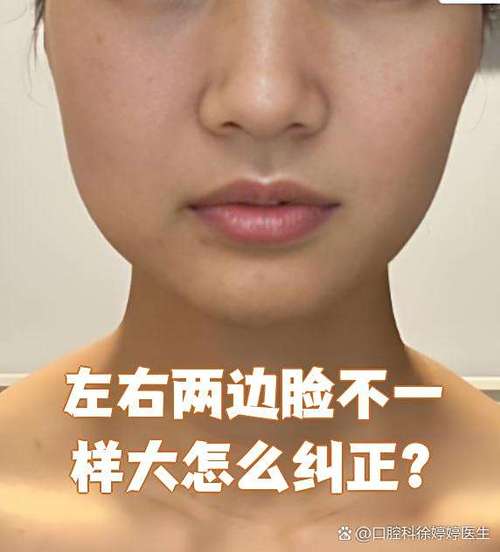 脸的两边不对称该怎么调整图标