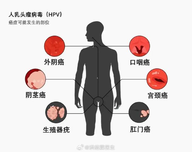 三聚磷酸钠对人体有什么害处图标