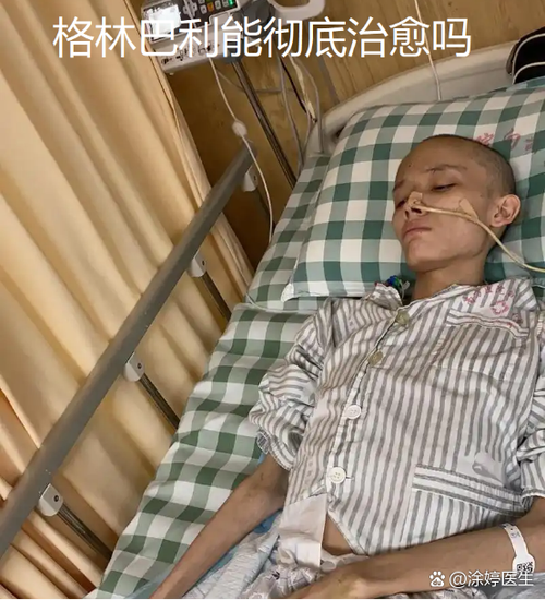 巴利综合症能治愈吗图标