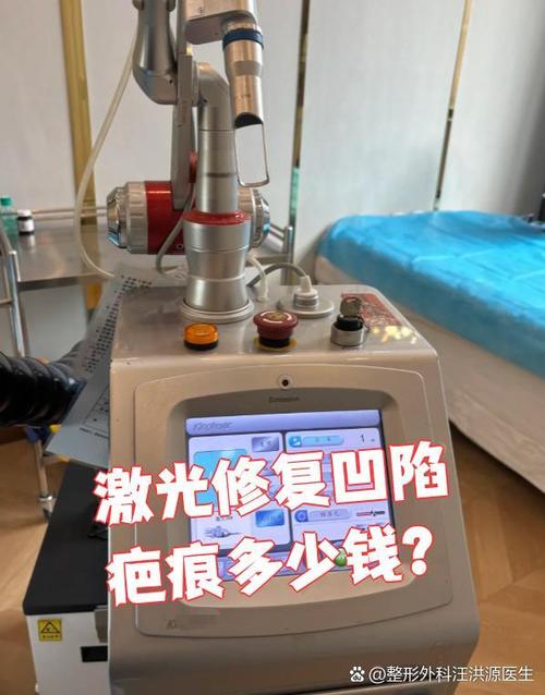 激光去疤痕大概需要多少钱呢